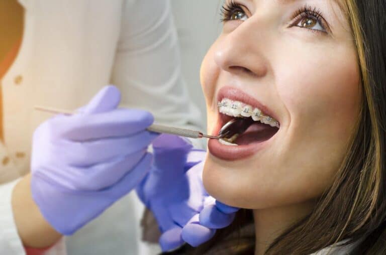 Dental Braces