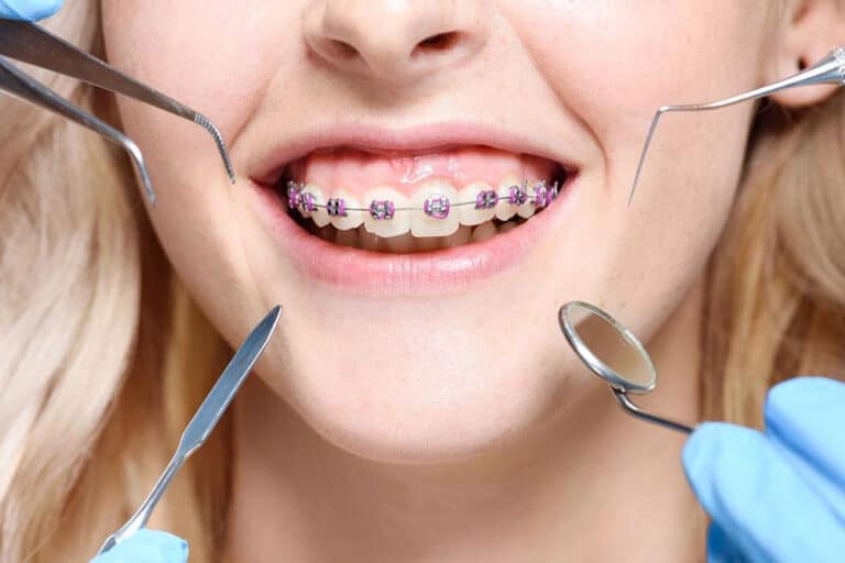 orthodontics treatment
