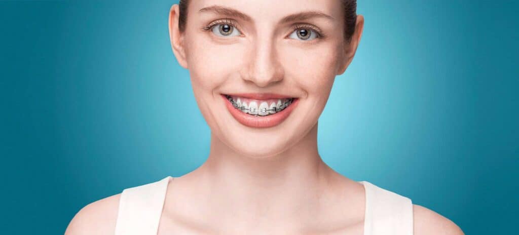 Woman smiling with metal braces