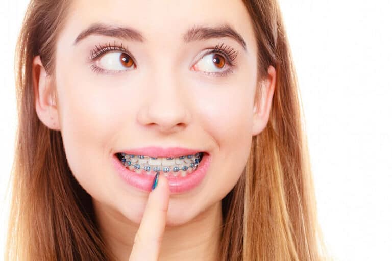 A Girl With Braces
