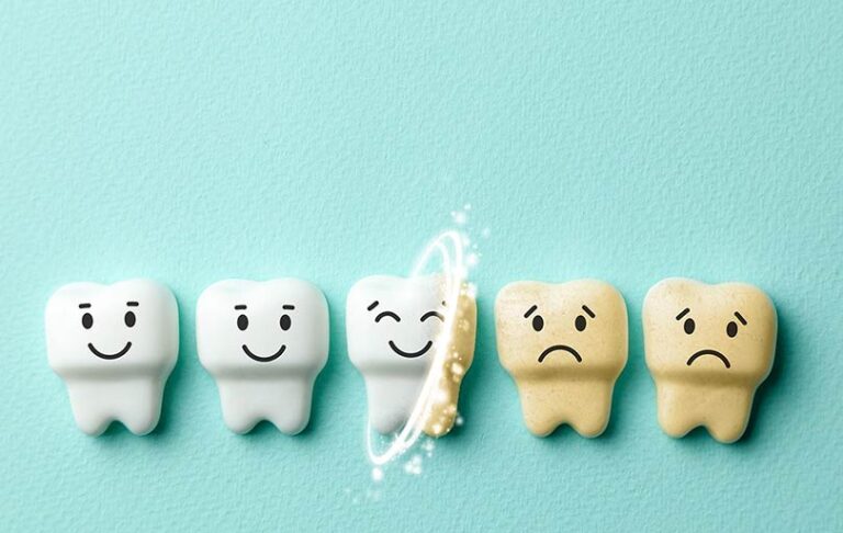 Graphical tooth decaying so fast