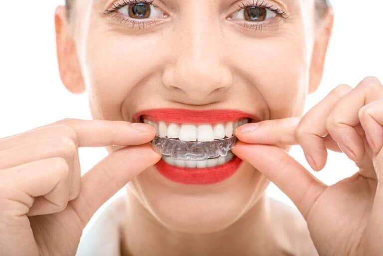 Woman wearing invisalign braces