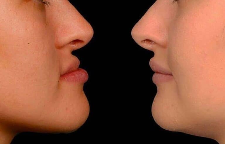 Orthodontic surgery image