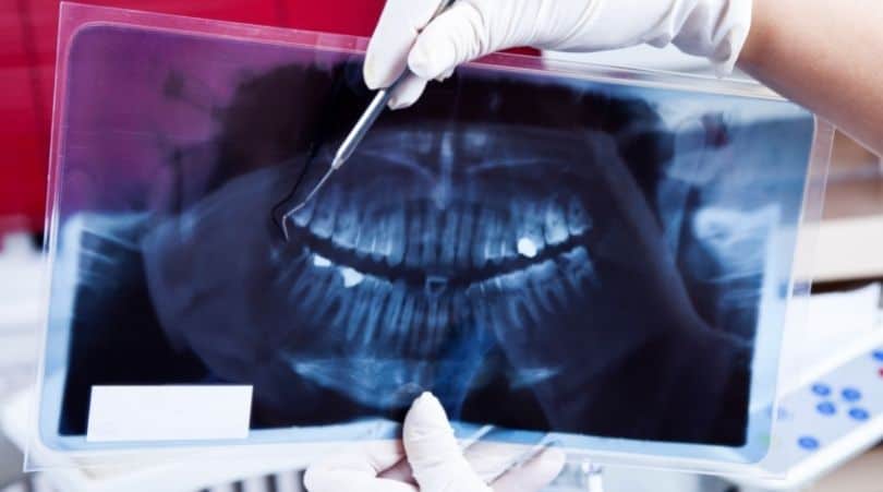 A dentist is holing a dental X-Ray image