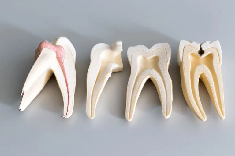 A tooth root dental model